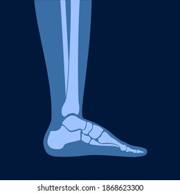 Human ankle icon for clinic. Normal foot joints and bones anatomy in leg silhouette. Skeleton x ray medical poster. Orthopedic or chiropractic treatment. Anatomical logo concept. vector illustration.