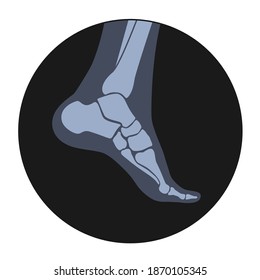 Human ankle icon for clinic. Normal foot joints and bones anatomy in leg silhouette. Skeleton x ray medical poster. Orthopedic or chiropractic treatment. Anatomical logo concept. vector illustration.