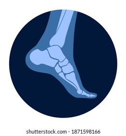 Human ankle icon for clinic. Normal foot joints and bones anatomy in leg silhouette. Skeleton x ray medical poster. Orthopedic or chiropractic treatment. Anatomical logo concept. vector illustration.