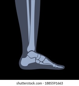 Human Ankle Icon For Clinic. Normal Foot Joints And Bones Anatomy In Leg Silhouette. Skeleton X Ray Medical Poster. Orthopedic Or Chiropractic Treatment. Anatomical Logo Concept. Vector Illustration.