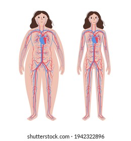 Sistema circulatorio arterial y venoso humano en el cuerpo femenino obeso. Diagrama de vasos sanguíneos en la silueta de mujeres con sobrepeso y normal. Infografía para uso médico. Ilustración aislada del vector anatómico
