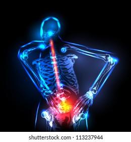 Human backbone in x-ray, back Pain, easy editable