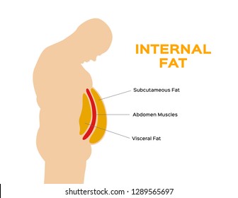 Human Belly And Abdomen Fat Layer Vector / Subcutaneous And Visceral Fat