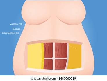 Human Belly And Abdomen Fat Layer Vector / Subcutaneous And Visceral Fat