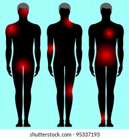 Human Body With Area Of Pain