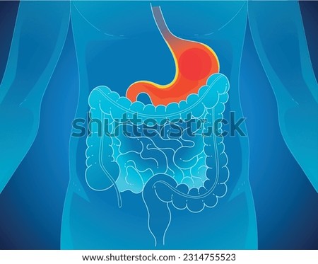 A human body with health problems. Inflammation on the stomach. Stomach (peptic) ulcer. Healthcare illustration. Medical illustration. Vector illustration. 