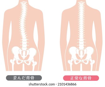 Cuerpo humano Espina normal y espina dorsal distorsionada

Se describe como "columna vertebral normal" y "espina dorsal distorsionada" en japonés.