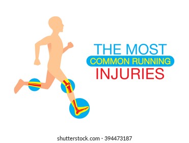 Human body part common injuries form running. This illustration about heath and sport.