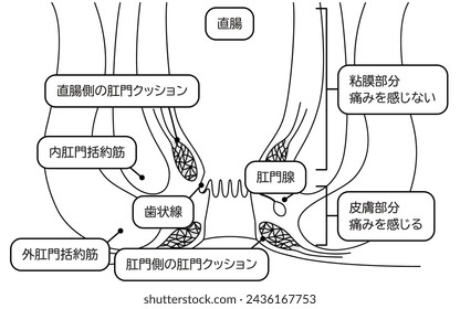 Área del recto y el ano del cuerpo humano Ilustraciones, vista de sección transversal - Traducción: Área de la membrana mucosa, área de la piel, área del recto, cojín anal