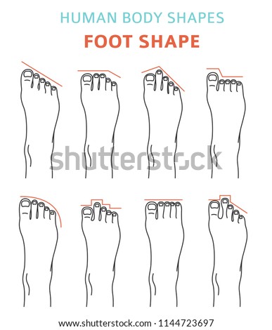 Human Body Shapes Feet Types Ixon Set Stock Vector (Royalty Free ...