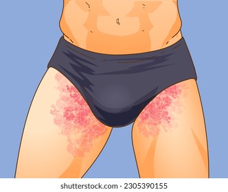 The human body with skin disease. Healthcare illustration. Vector illustration. 