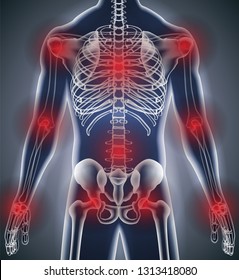 Human body x-ray bone anatomy joints pains red alert. Vector illustration for advertising of medical and health products.