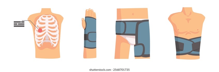 Human Bone and Joint Fracture and Rehabilitation Object Vector Set