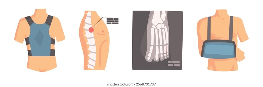 Human Bone and Joint Fracture and Rehabilitation Object Vector Set