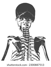 Human Bones with Black and White Color