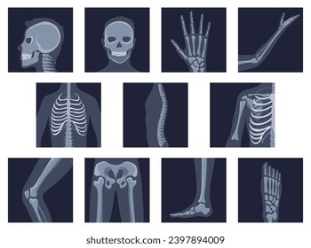 Human bones orthopedic and skeleton icon set, bone x-ray image of human joints, anatomy skeleton flat design vector illustration