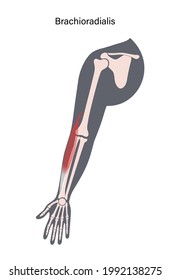 Human brachioradialis and muscular system. Humerus, radius, ulna and scapula bone anatomical poster. Hand bones, joints anatomy. Medical flat vector illustration for clinic, or education. X ray image.