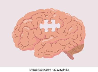Human brain with space in shape like a jigsaw of the puzzle. Illustration about dementia and Alzheimer's disease and losing memory.