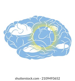 Human brain as sunny day. Creative concept for positive thinking. On the bright side.