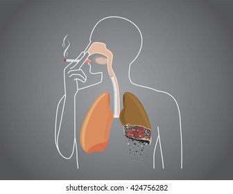 Human burned down lung with smoking. This illustration about health care.