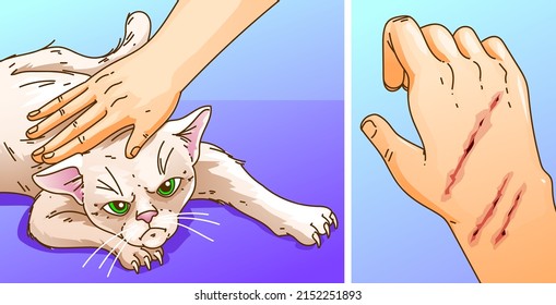 Human caresses cat. Cat scratched a human. Scratches on the skin. Healthcare illustration. Vector illustration.