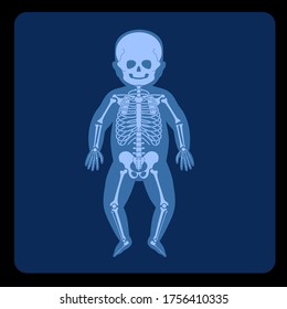 Human child skeleton anatomy in front on x ray view. Vector isolated flat illustration of skull and bones in baby body. Medical, educational or science banner on blue background.