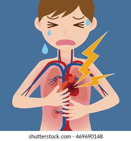 human circulatory system and heart infarction, cardiac infarction, myocardial infarct, simplified anatomical chart