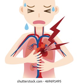 human circulatory system and heart infarction, cardiac infarction, myocardial infarct, simplified anatomical chart