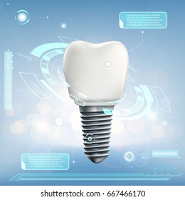 Human dental implant. Futuristic infographics of the tooth. Stock vector illustration.