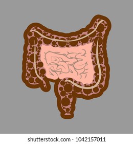 Human digestive system intestines gut anatomy gastrointestinal tract diagram. Meteorism, Enteritis, Colitis, Ulcerative Colitis, Dysbacteriosis, Diarrhea. Diseases of the intestine