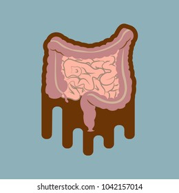 Human digestive system intestines gut anatomy gastrointestinal tract diagram. Meteorism, Enteritis, Colitis, Ulcerative Colitis, Dysbacteriosis, Diarrhea. Diseases of the intestine