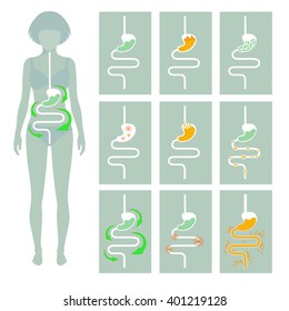 Human Digestive System, Vector Illustration Of Digestion Tract Disease