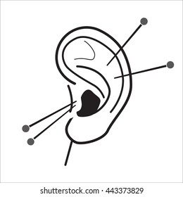 Human Ear acupuncture with needles vector illustration. Medical procedure illustration. Chinese Traditional, Alternative Medicine, Natural Healing and Recreation vector icon.