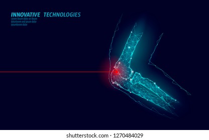 Human elbow joint 3d model vector illustration. Low poly design future technology cure pain treatment. Blue background and red injury man body arm medicine template