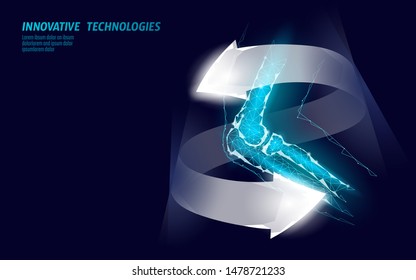 Human elbow joint 3d model vector illustration. Low poly design future technology cure arm pain treatment. Recovery cure glowing arrow gel medicine vector illustration