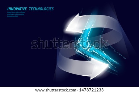 Human elbow joint 3d model vector illustration. Low poly design future technology cure arm pain treatment. Recovery cure glowing arrow gel medicine vector illustration