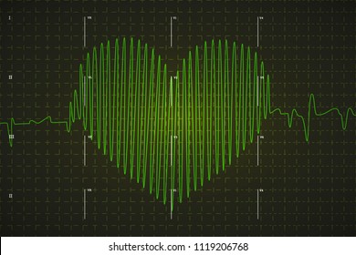 Human electrocardiogram graph in heart shape, bright green graph on dark background with medical marks