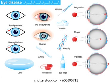 human eye diseases and disorders. Medical Infographic set with icons and other elements. medical symbols for design