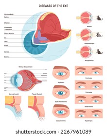 Human eye diseases set. Human vision organ, eyesight and eyelid problem. Medical symptoms and vision disorders. Internal anatomical structure of human eye. Flat vector illustration