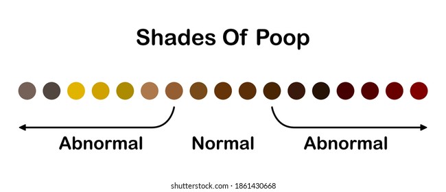 Human Feces Color Shades Color Poop Stock Vector (Royalty Free ...