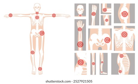 Human figure highlighting common pain points linked to rheumatic disorders, including joints and skeletal regions in a clear, educational format.