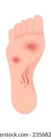 Ilustración del vector de enfermedades de los pies humanos