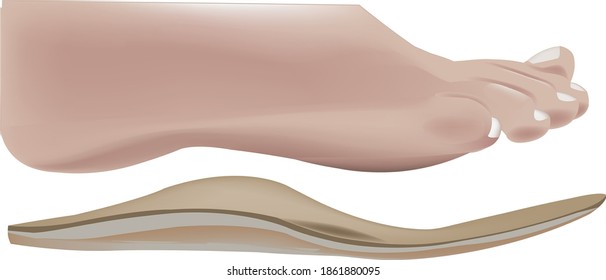 human foot with plantar insole for walking