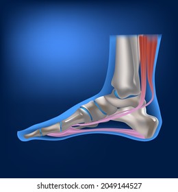 The human foot from the side. Anatomical structure of leg bones and ligaments. 3D rendering of the foot. Vector illustration
Valgus deformity of the big toe. Bones on the feet or bumps on the feet, g