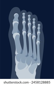 Human foot xray leg bone structure medical diagnostic top view vector flat illustration. Feet x ray skeletal anatomy joint orthopedic scientific shot for healthcare clinic medicine research body care