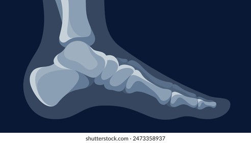 Human foot xray structure roentgen radiology image for medical diagnostic vector flat illustration. Feet leg bone skeleton x ray shot side view science hospital healthcare orthopedics anatomy