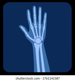 Human Forearm Anatomy, X Ray View. Wrist And Hand Bones On Reontgen. Vector Illustration Isolated On White Background. Skeletal System Silhouette. Medical, Educational And Science Banner