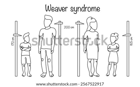 A human genetic disorder associated with rapid growth, beginning in the prenatal period and continuing through childhood and adolescence. People of average height and people with Weaver syndrome.