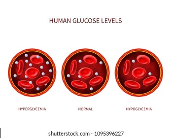 3,322 Hypoglycemia Stock Vectors, Images & Vector Art | Shutterstock