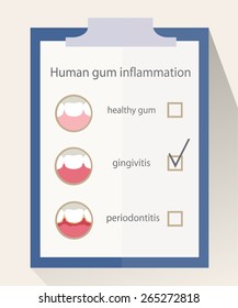 Entzündung des menschlichen Zahnfleisches.Untersuchungsergebnis-Gingivitis.